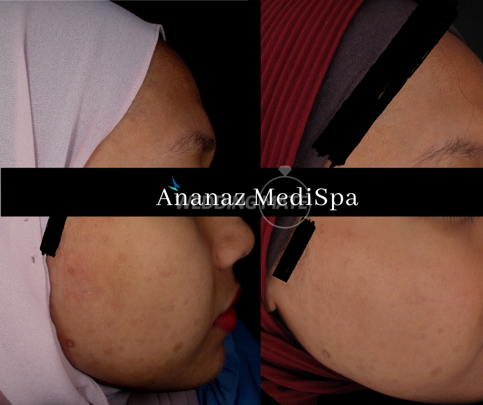 Ananaz Medi Spa - Bangi Sentral